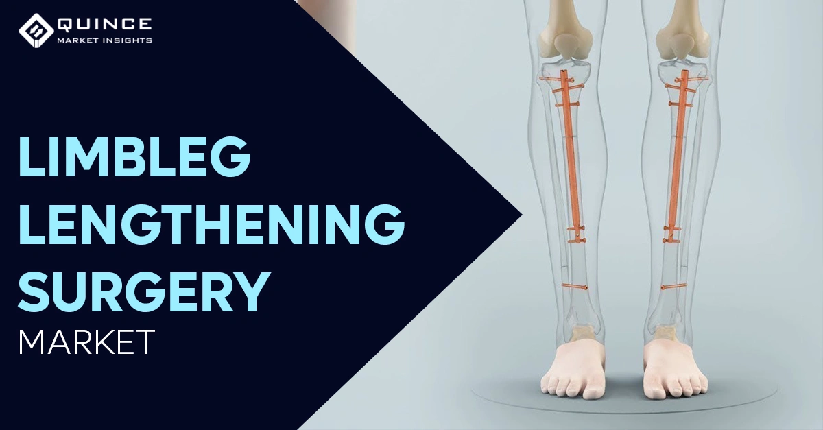 Evolution of the Limb/Leg Lengthening Surgery, Growth Drivers, COVID-19 Impact, & Recent Advancements