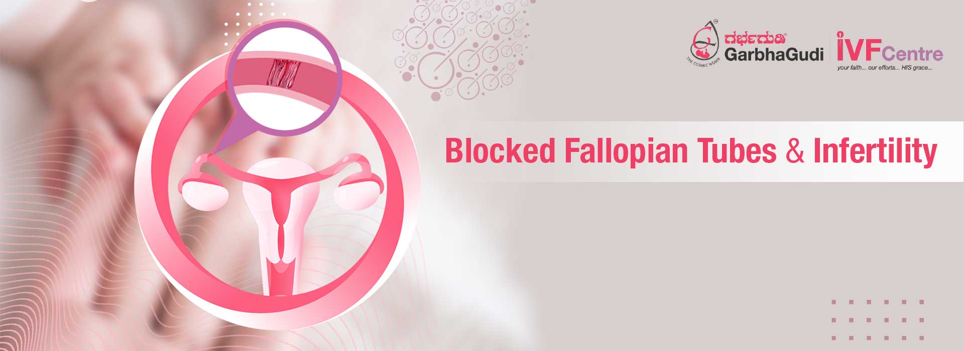 Blocked Fallopian Tubes And Infertility