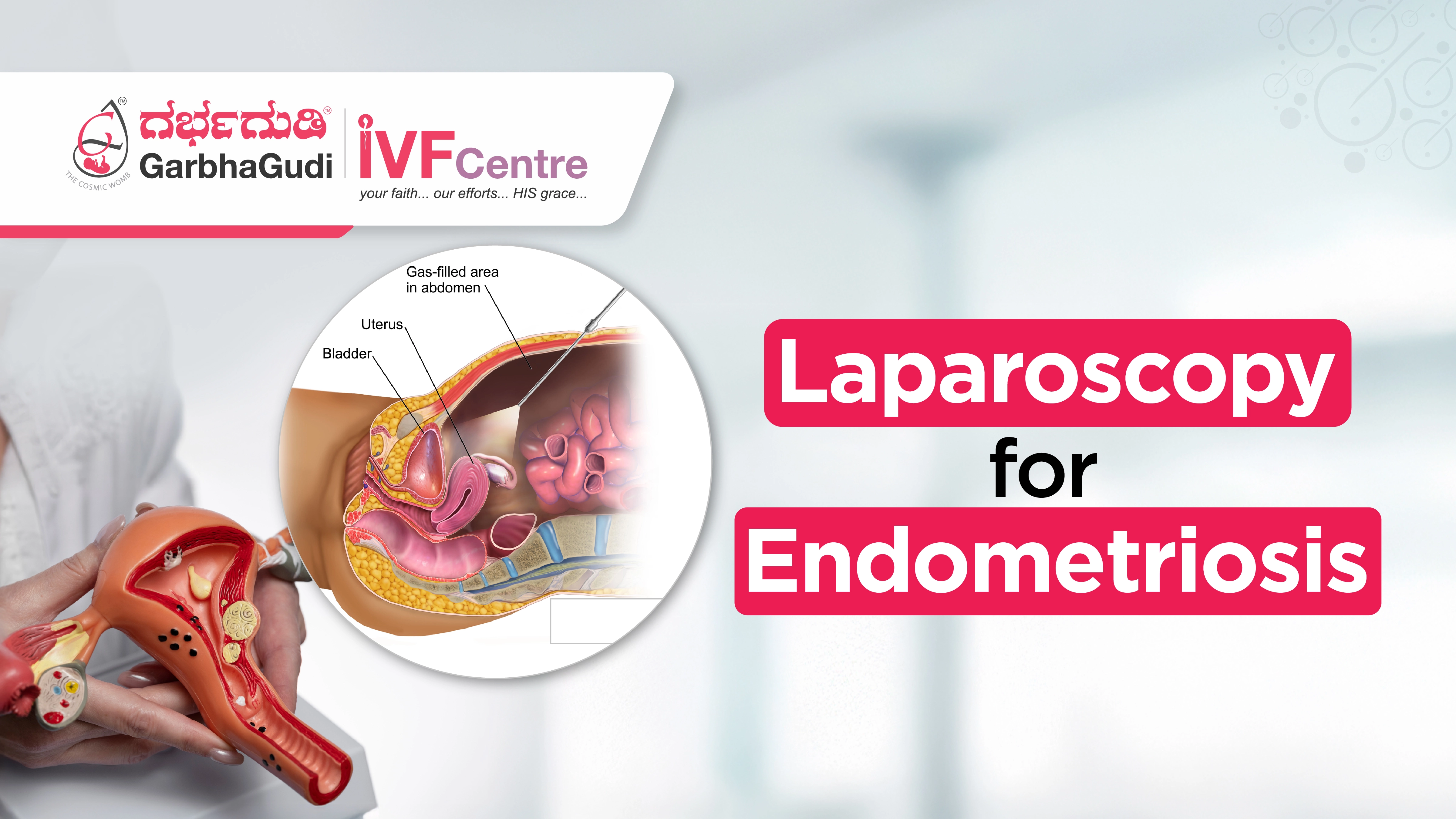 Laparoscopy for Endometriosis: How It Can Improve Fertility