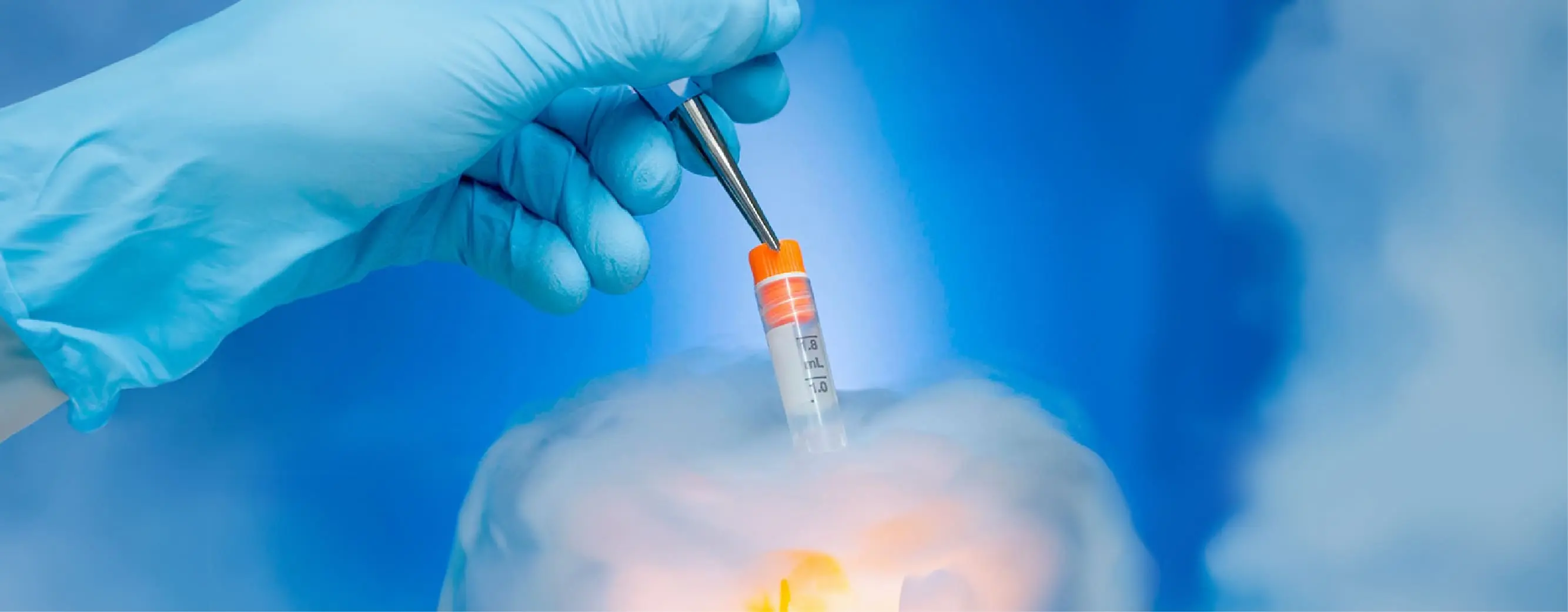 egg-freezing-in-bangalore