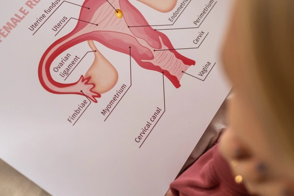 What is endometriosis