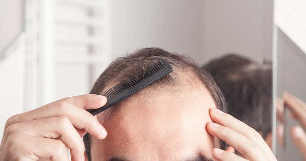 Hair Transplant Side Effects 