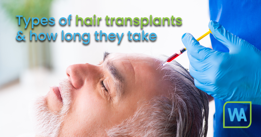 Types of hair transplants and how long they take