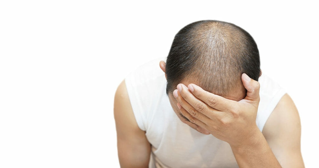 Hair Transplant Side Effects 