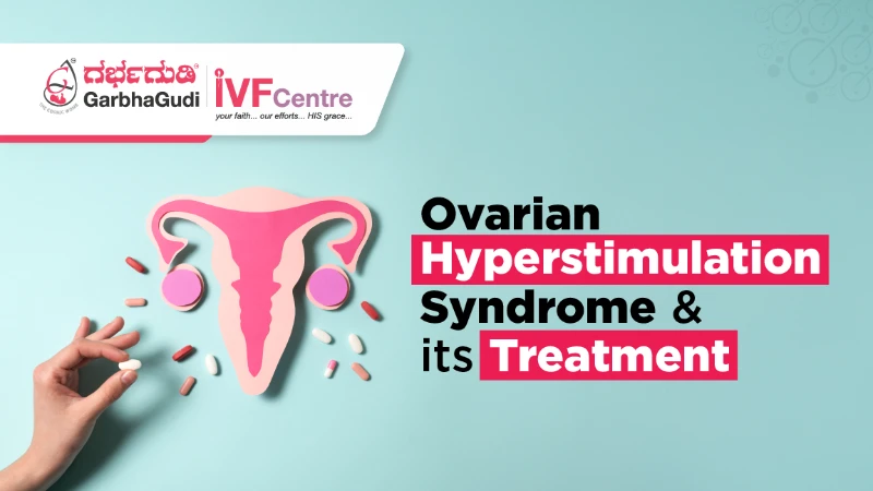 What Is Ovarian Hyperstimulation Syndrome, and How Is It Treated?