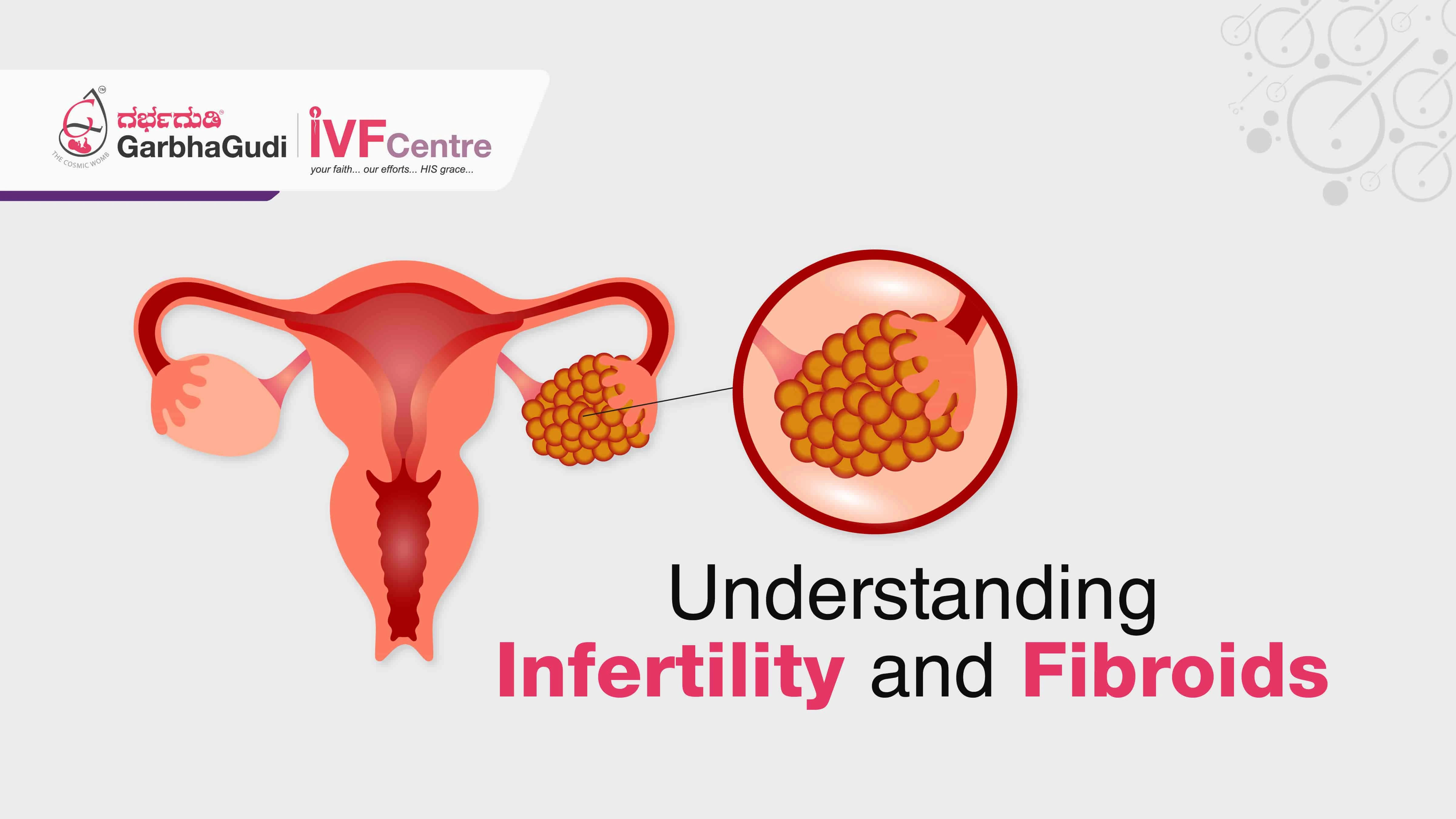  Understanding Infertility and Fibroids