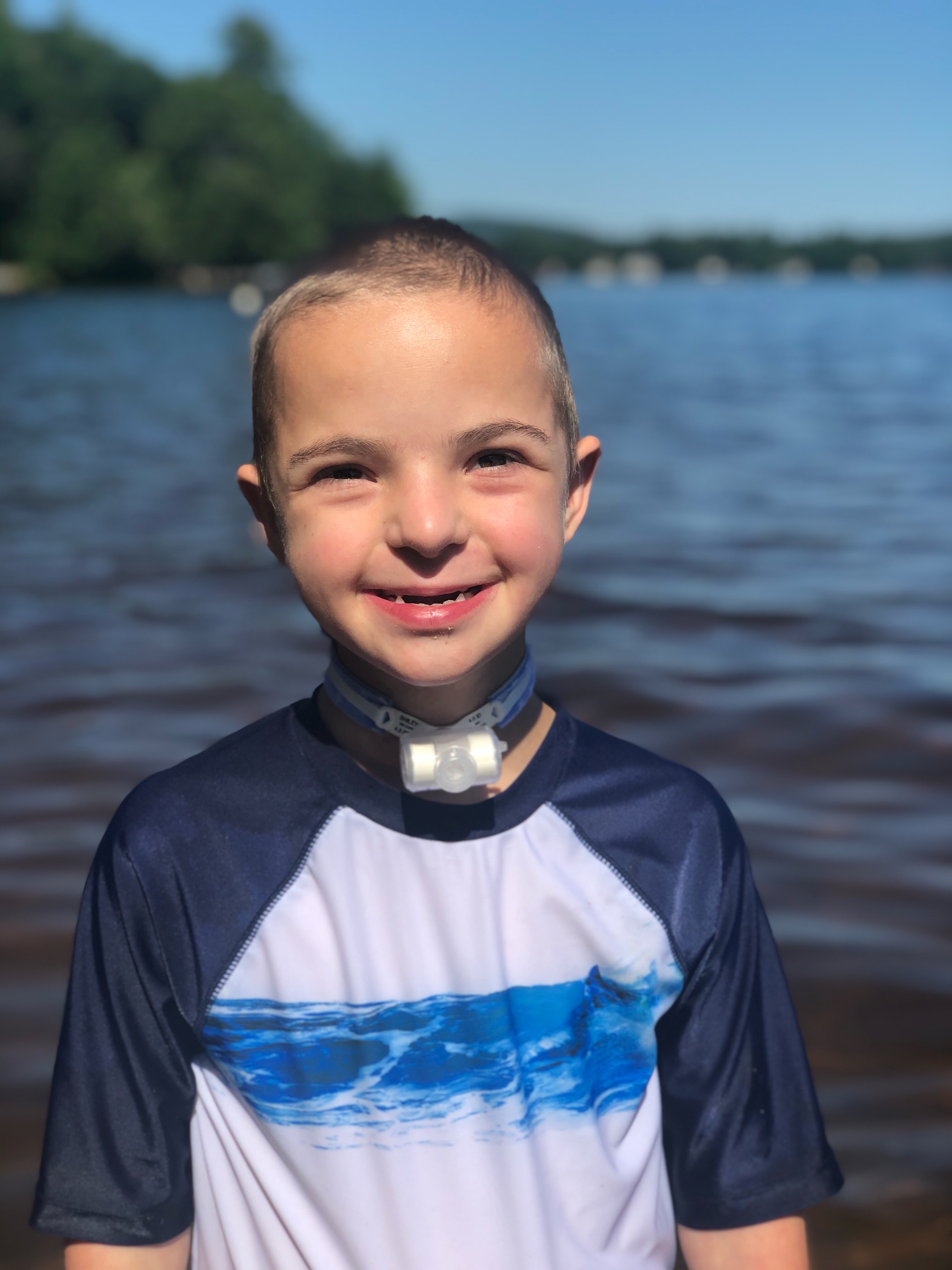 A young boy with down syndrome smiling and standing in front of a lake