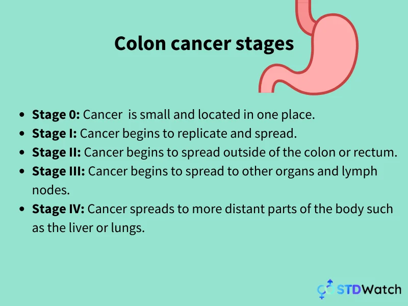 colon-cancer-stages