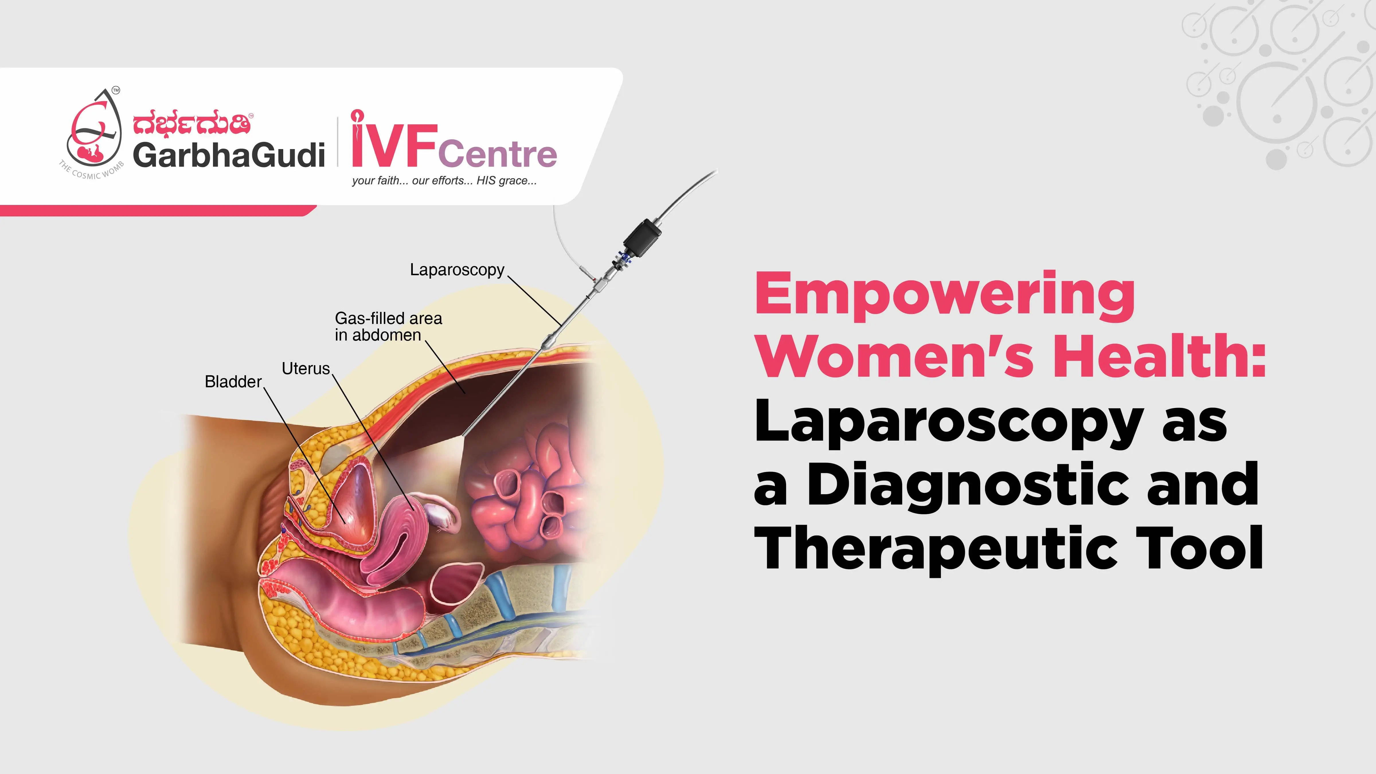 Empowering Women's Health: Laparoscopy as a Diagnostic and Therapeutic Tool