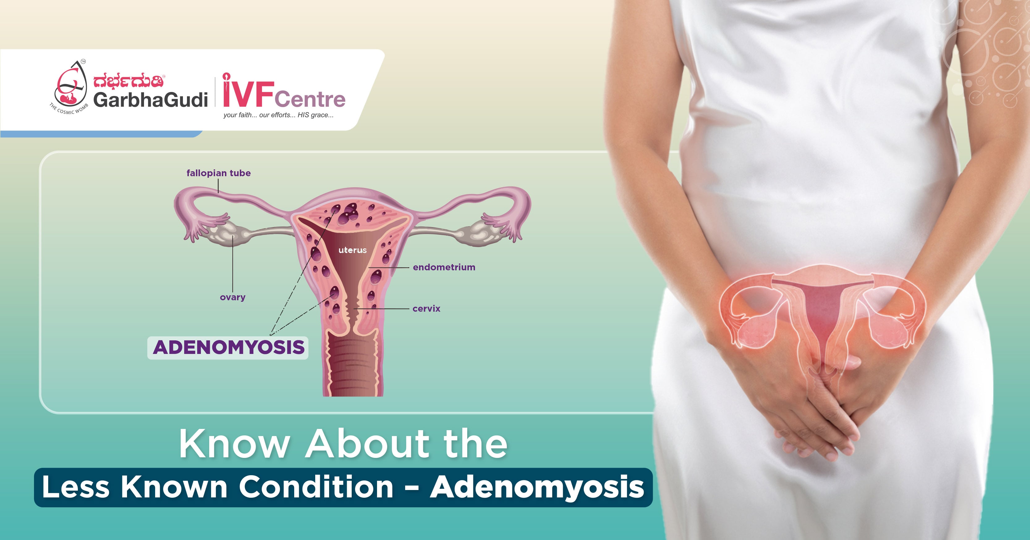 Know About the Less Known Condition – Adenomyosis